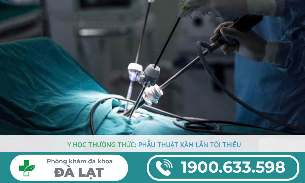Hình ảnh minh họa